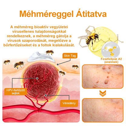 🍃🐝TURONU™ méhméreg szemölcs és anyajegy eltávolító krém (Utolsó napi akció, 80% kedvezmény)